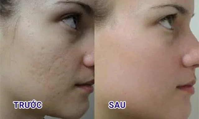 cach su dung serum ca hoi suiskin1