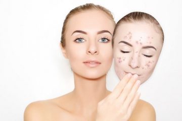 spa trị mụn Đà Nẵng